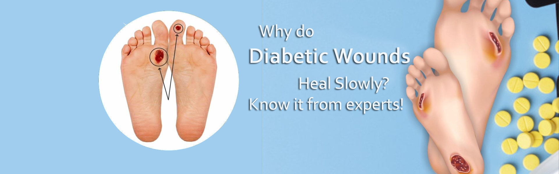 Best Diabetic Foot Doctor in Bhopal, Central India